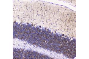 IHC analysis of Betacellulin using anti-Betacellulin antibody . (Betacellulin antibody  (AA 32-177))
