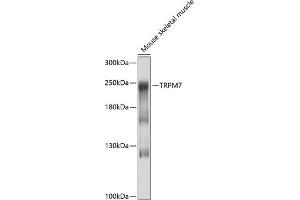 Western blot analysis of extracts of mouse skeletal muscle, using TRPM7 antibody (ABIN6127694, ABIN6149588, ABIN6149589 and ABIN6214200) at 1:1000 dilution. (TRPM7 antibody  (AA 756-855))