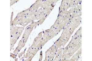Immunohistochemistry of paraffin-embedded Mouse heart using ACSS2 Polyclonal Antibody at dilution of 1:100 (40x lens). (ACSS2 antibody)