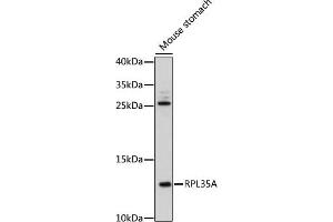 RPL35A Antikörper  (AA 10-90)
