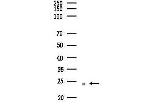 anti-RhoA,B,C antibody