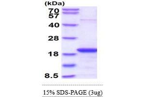 SDS-PAGE (SDS) image for S-Phase Kinase-Associated Protein 1 (SKP1) (AA 1-160) protein (ABIN666914)