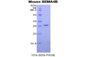 SDS-PAGE (SDS) image for Sema Domain, Immunoglobulin Domain (Ig), Transmembrane Domain (TM) and Short Cytoplasmic Domain, (Semaphorin) 4B (SEMA4B) (AA 31-240) protein (His tag) (ABIN2122064) (SEMA4B Protein (AA 31-240) (His tag))