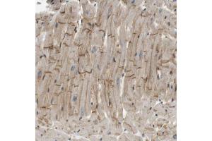Immunohistochemical staining (Formalin-fixed paraffin-embedded sections) of human heart muscle with TSPAN9 polyclonal antibody  shows moderate positivity in intercalated discs. (Tetraspanin 9 antibody  (AA 123-200))