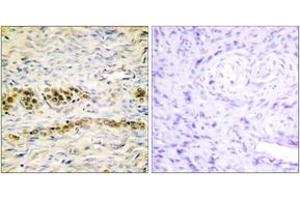 Immunohistochemistry analysis of paraffin-embedded human ovary, using Akt (Phospho-Tyr474) Antibody.