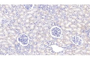 Detection of PIGR in Bovine Kidney Tissue using Polyclonal Antibody to Polymeric Immunoglobulin Receptor (PIGR) (PIGR antibody  (AA 250-341))
