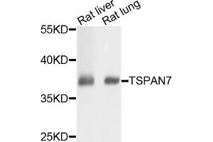 Western blot analysis of extracts of rat liver and rat lung cells, using TSPAN7 antibody. (Tetraspanin 7 antibody)