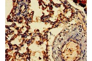 Immunohistochemistry of paraffin-embedded human lung tissue using ABIN7143442 at dilution of 1:100 (ARF1 antibody  (AA 2-181))