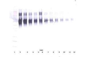 Image no. 1 for anti-Intercellular Adhesion Molecule 1 (ICAM1) antibody (ABIN465661) (ICAM1 antibody)