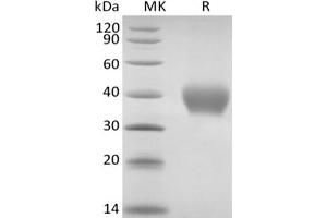TNF Receptor II/TNF RII/TNFRSF1B/CD120b protein (His tag)