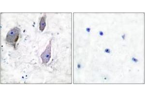 Immunohistochemistry analysis of paraffin-embedded human brain tissue, using PMP22 Antibody.