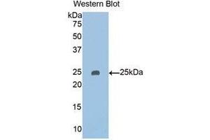 Western Blotting (WB) image for anti-Pappalysin 2 (PAPPA2) (AA 888-1093) antibody (ABIN1860128) (PAPPA2 antibody  (AA 888-1093))