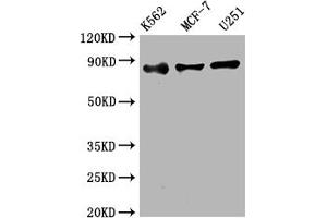 Western Blot Positive WB detected in: K562 whole cell lysate, MCF-7 whole cell lysate, U251 whole cell lysate All lanes: IKK beta antibody at 1:2000 Secondary Goat polyclonal to rabbit IgG at 1/50000 dilution Predicted band size: 87 kDa Observed band size: 87 kDa (Recombinant IKBKB antibody)
