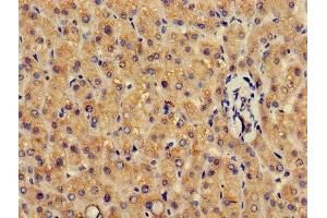 Immunohistochemistry of paraffin-embedded human liver tissue using ABIN7154093 at dilution of 1:100 (GSTA4 antibody  (AA 1-222))