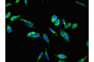 Immunofluorescent analysis of Hela cells using ABIN7147989 at dilution of 1:100 and Alexa Fluor 488-congugated AffiniPure Goat Anti-Rabbit IgG(H+L) (Coagulation Factor IX antibody  (AA 144-239))