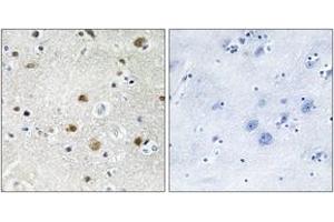 Immunohistochemistry analysis of paraffin-embedded human brain tissue, using TF3B Antibody.