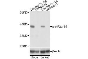 Western blot analysis of extracts of HeLa and Jurkat cells,using Phospho-eIF2α-S51 antibody. (EIF2S1 antibody  (pSer51))
