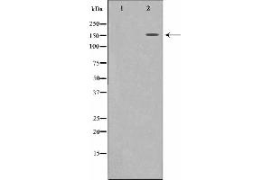 Western blot analysis on 293 cell lysate using MRC2 Antibody,The lane on the left is treated with the antigen-specific peptide.