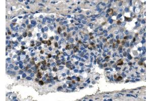IHC analysis of TMPRSS3 using anti-TMPRSS3 antibody (ABIN7601198).