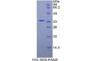 SDS-PAGE analysis of Mouse ECE1 Protein. (ECE1 Protein)