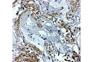 Immunohistochemistry of TNFAIP3 in human lung tissue with TNFAIP3 polyclonal antibody  at 5 ug/mL .