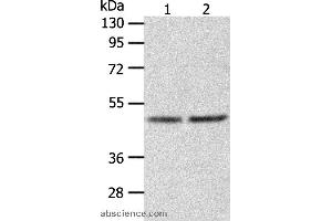 Western blot analysis of Human fetal liver tissue and hepg2 cell, using AGXT Polyclonal Antibody at dilution of 1:1050