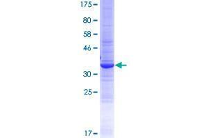 WFDC12 Protein (AA 1-111) (GST tag)