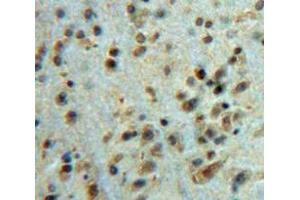Used in DAB staining on fromalin fixed paraffin-embedded Brain tissue (Ataxin 1 antibody  (AA 331-587))