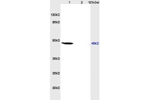 L1 human colon carcinoma lysates L2 rat heart lysates probed with Anti IL-2R gamma/CD132 Polyclonal Antibody, Unconjugated (ABIN669516) at 1:200 overnight at 4 °C. (Retinoic Acid Receptor beta antibody  (AA 155-250))