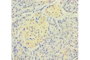 Immunohistochemistry of paraffin-embedded human pancreatic tissue using ABIN7147970 at dilution of 1:100 (IREM1 antibody  (AA 20-156))