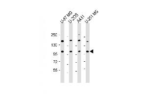 THSD1 antibody  (AA 668-699)