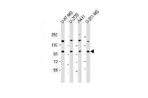 All lanes : Anti-THSD1 Antibody (C-Term) at 1:2000 dilution Lane 1: U-87 MG whole cell lysate Lane 2: U-2OS whole cell lysate Lane 3: A431 whole cell lysate Lane 4: U-251 MG whole cell lysate Lysates/proteins at 20 μg per lane. (THSD1 antibody  (AA 668-699))