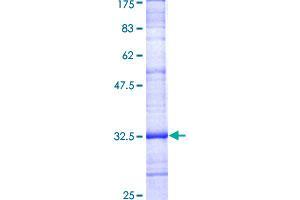 PMP22 Protein (AA 25-114) (GST tag)