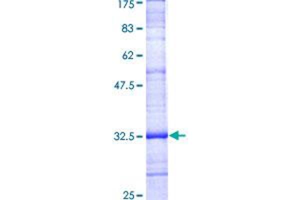 PMP22 Protein (AA 25-114) (GST tag)