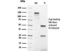 SDS-PAGE Analysis Purified IgG4 Mouse Recombinant Monoclonal Antibody (rIGHG4/1345). (Recombinant IGHG4 antibody)