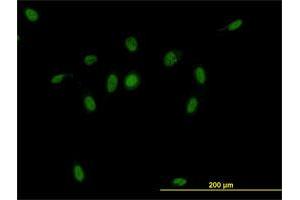 Immunofluorescence of monoclonal antibody to CSE1L on HeLa cell. (Exportin 2 antibody  (AA 872-971))