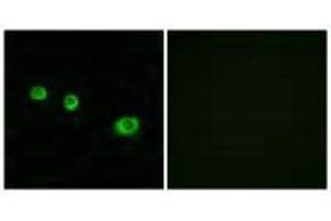 Immunofluorescence analysis of MCF-7 cells, using GBP1 antibody. (GBP1 antibody)