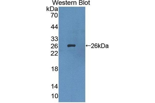 LIM2 anticorps  (AA 30-136)