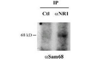 Immunoprecipitation with anti NR1 or control Western blot anti Sam68 (KHDRBS1 antibody)