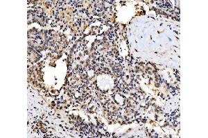IHC analysis of CPSF6 using anti-CPSF6 antibody (ABIN7601898).