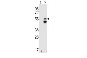 Western blot analysis of FRK (arrow) using rabbit polyclonal FRK Antibody (V28) (ABIN392097 and ABIN2841849). (FRK antibody  (N-Term))