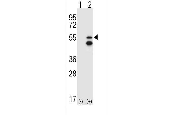 FRK anticorps  (N-Term)