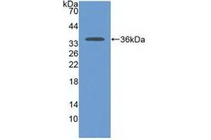 Detection of Recombinant CDH17, Human using Polyclonal Antibody to Cadherin 17 (CDH17) (LI Cadherin antibody  (AA 67-351))
