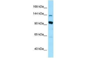 WB Suggested Anti-USO1 Antibody Titration: 1. (USO1 antibody  (N-Term))