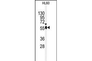 Western blot analysis of anti-NEK2 Antibody (Center) (ABIN392650 and ABIN2842150) in HL60 cell line lysates (35 μg/lane). (NEK2 antibody  (AA 396-426))