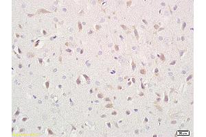 Formalin-fixed and paraffin embedded rat brain labeled with Anti- CD171/NCAM-L1 Polyclonal Antibody, Unconjugated (ABIN676463) at 1:400 followed by conjugation to the secondary antibody and DAB staining (L1CAM antibody  (AA 1101-1257))