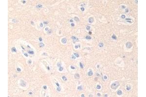 Detection of EPN1 in Human Cerebrum Tissue using Polyclonal Antibody to Epsin 1 (EPN1) (Epsin 1 antibody  (AA 279-437))