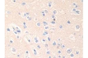 Detection of EPN1 in Human Cerebrum Tissue using Polyclonal Antibody to Epsin 1 (EPN1)