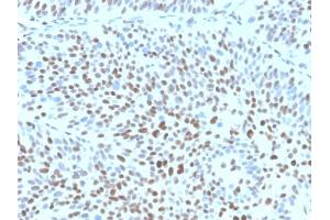 IHC analysis of formalin-fixed, paraffin-embedded human bladder. (Recombinant CDKN1B antibody)