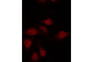 ABIN6275922 staining HepG2 by IF/ICC. (CXCR7 antibody  (Internal Region))